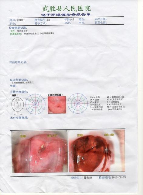 宫颈糜烂最新手术治疗，进展、优势与未来展望综述